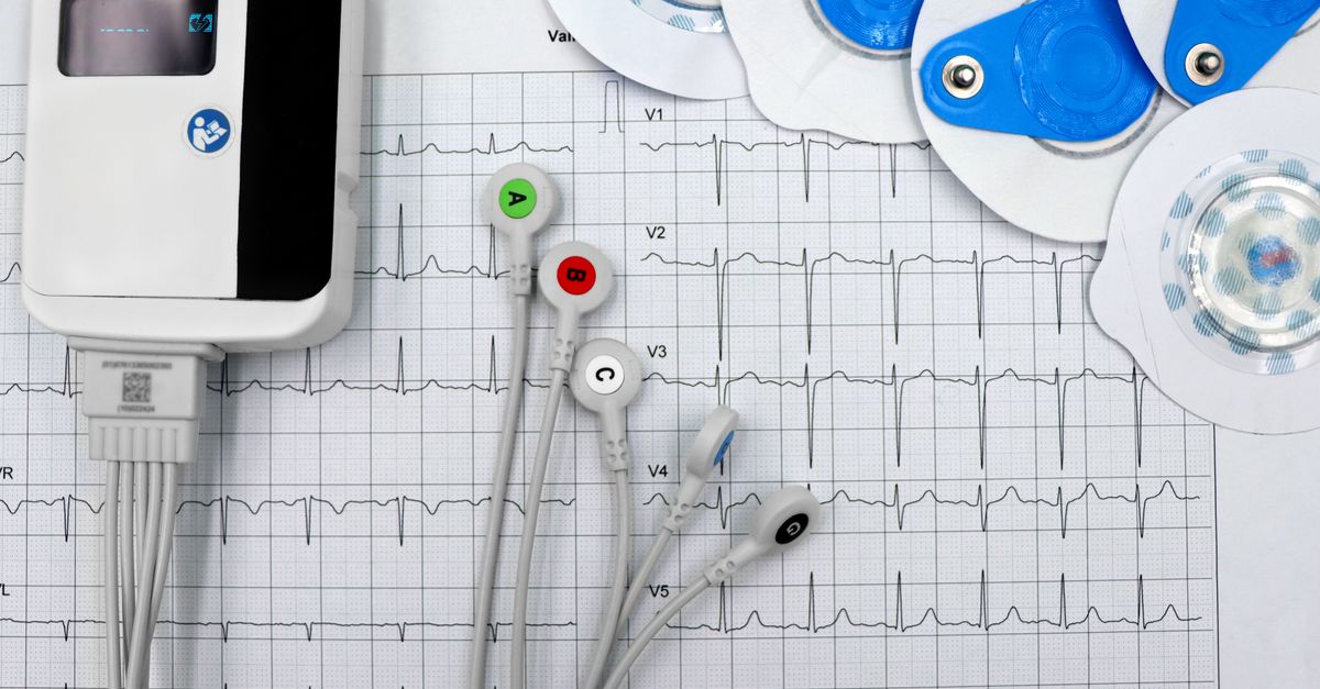 Traçado de eletrocardiograma em papel com eletrodos e gravador Holter